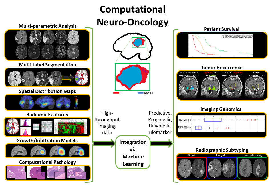 ABIL Computational Neuro Oncology Graphic